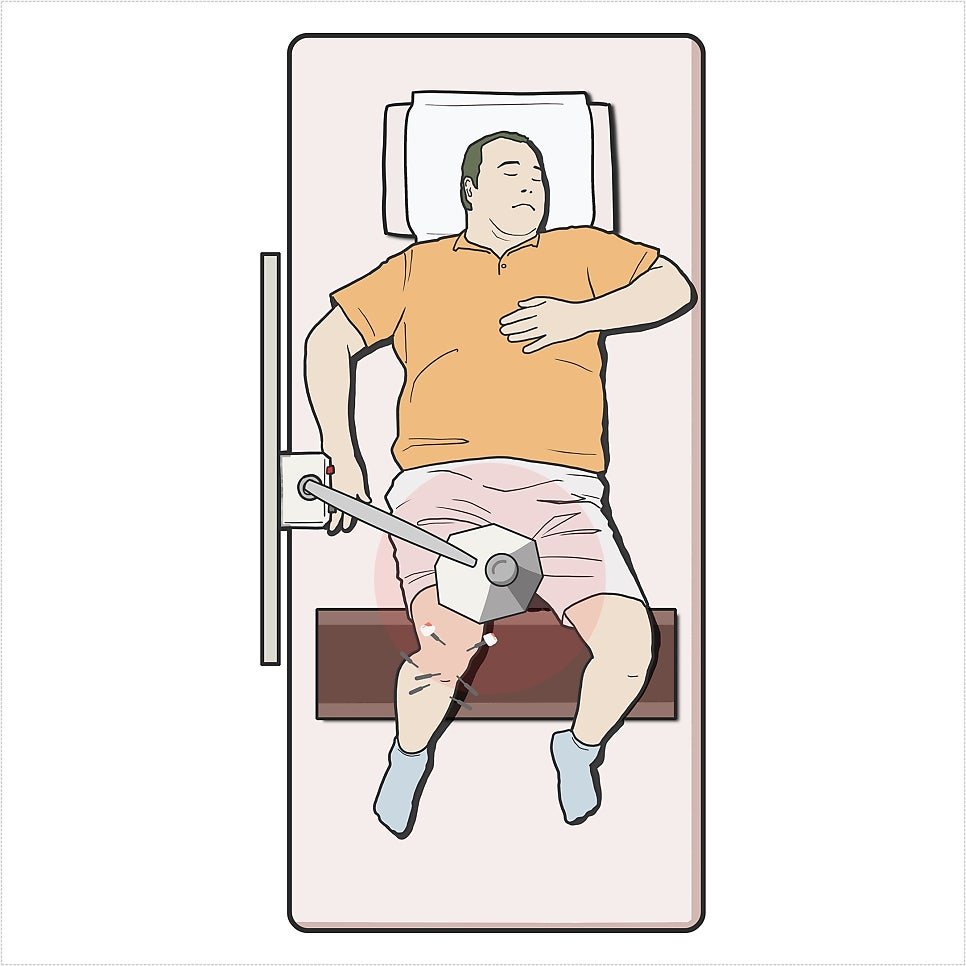 제주시 봄철 야외 운동 후 무릎 통증 원인과 관리 방법 (11)