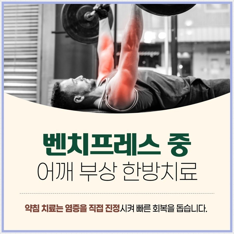 벤치프레스 중 어깨를 다쳤을 때 제주시 화북동 한의원